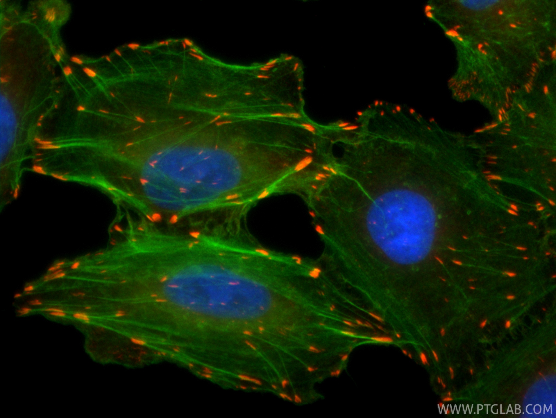 IF Staining of A549 using CL594-86117-3 IF Staining of A549 using CL594-86117-3