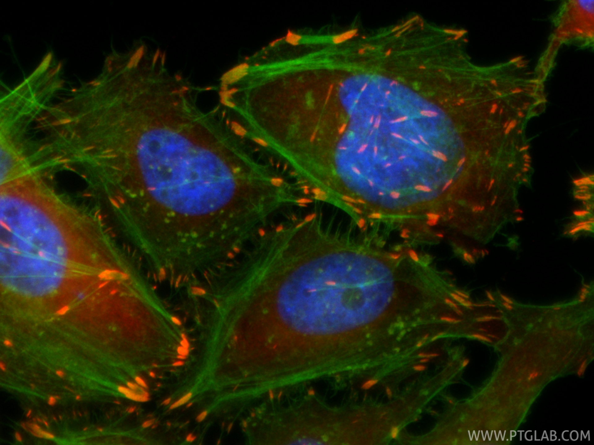 IF Staining of HeLa using CL594-86117-3 IF Staining of HeLa using CL594-86117-3