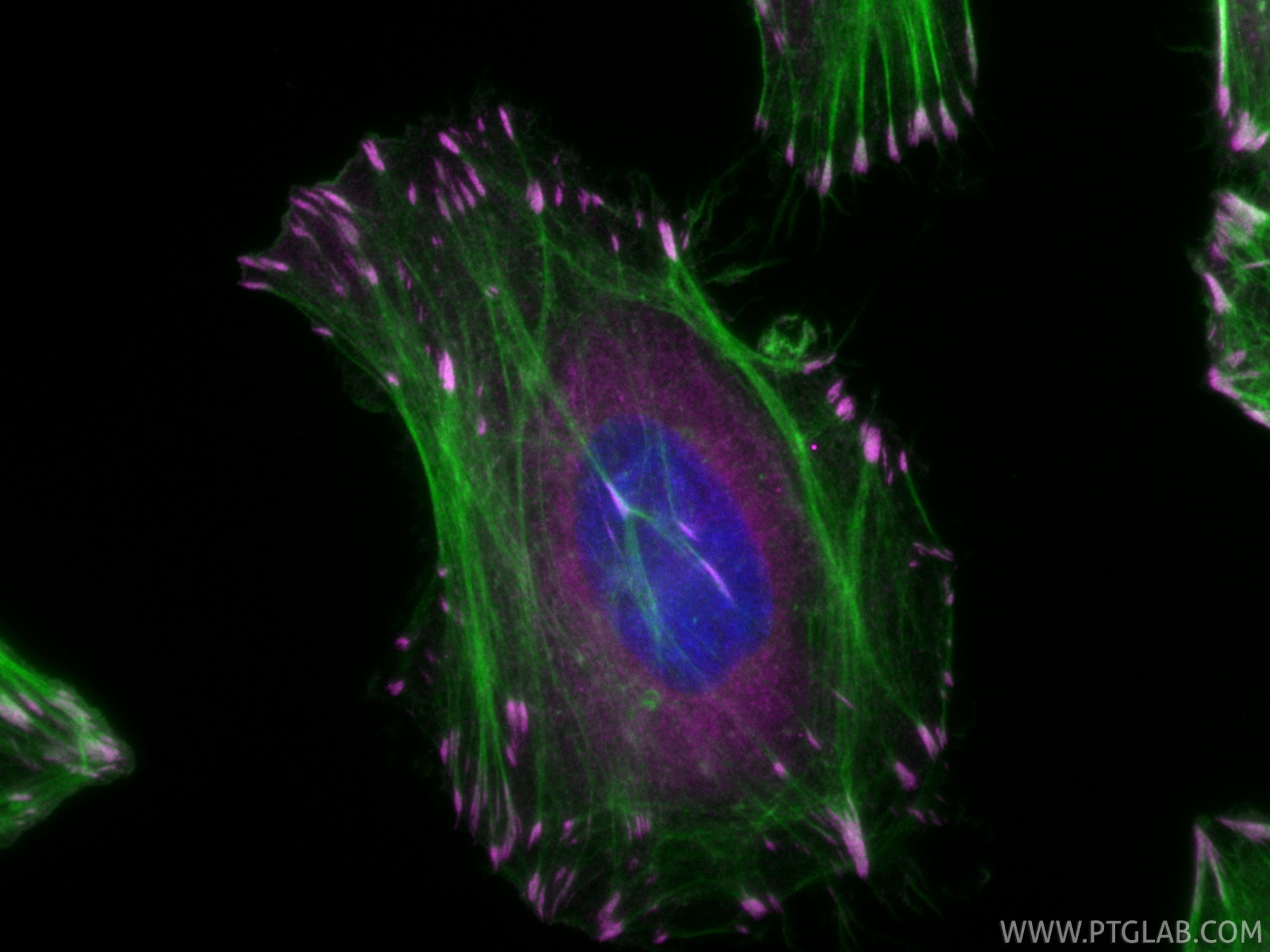 IF Staining of HeLa using CL647-86117-3