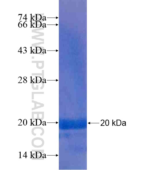 LPPR4 fusion protein Ag20401 SDS-PAGE LPPR4 fusion protein Ag20401 SDS-PAGE