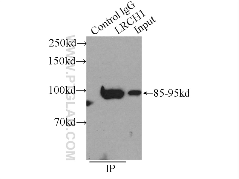 IP experiment of HeLa using 25017-1-AP