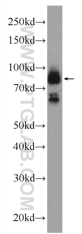 WB analysis of mouse brain using 24866-1-AP