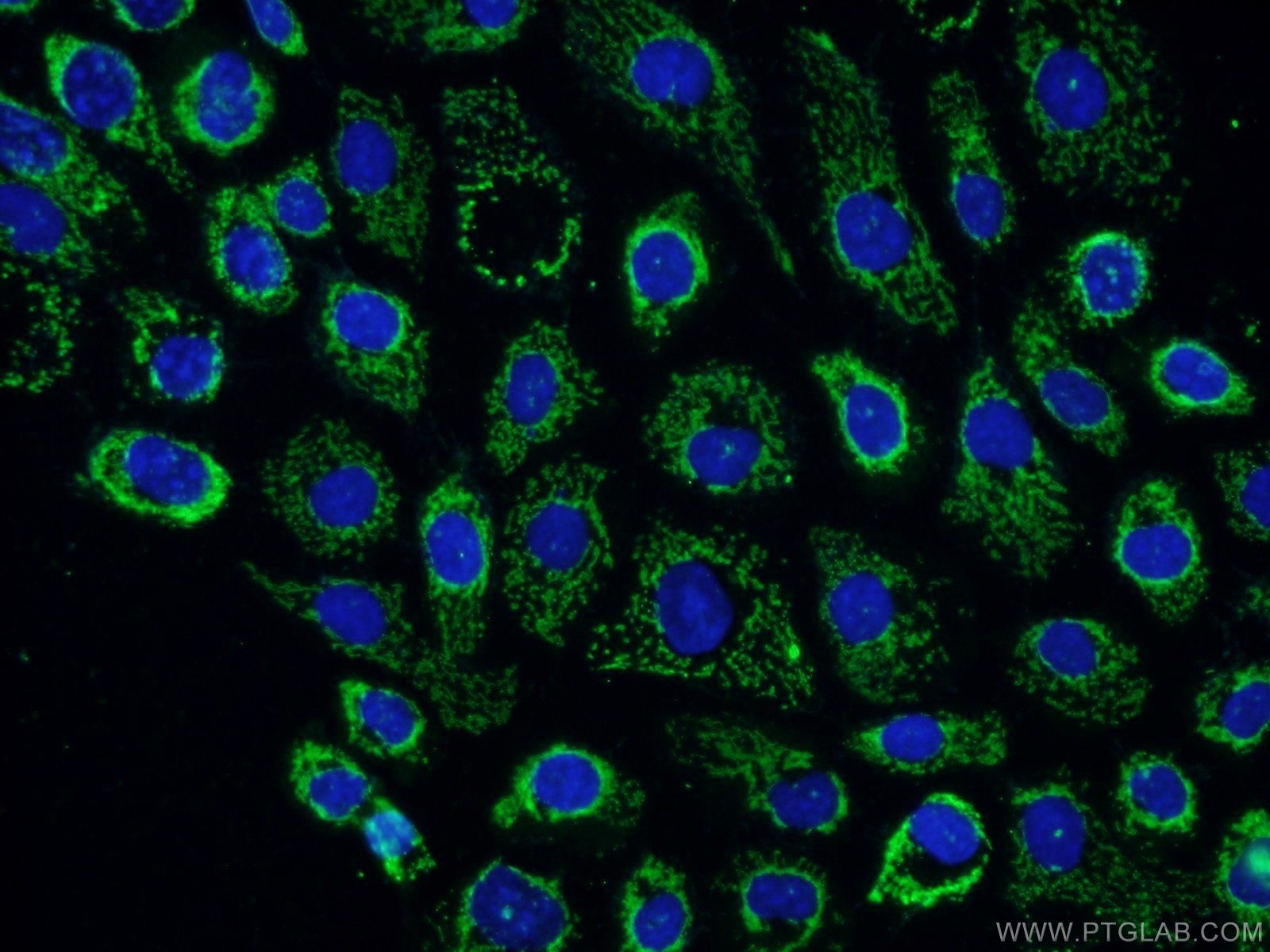 IF Staining of A431 using 15800-1-AP