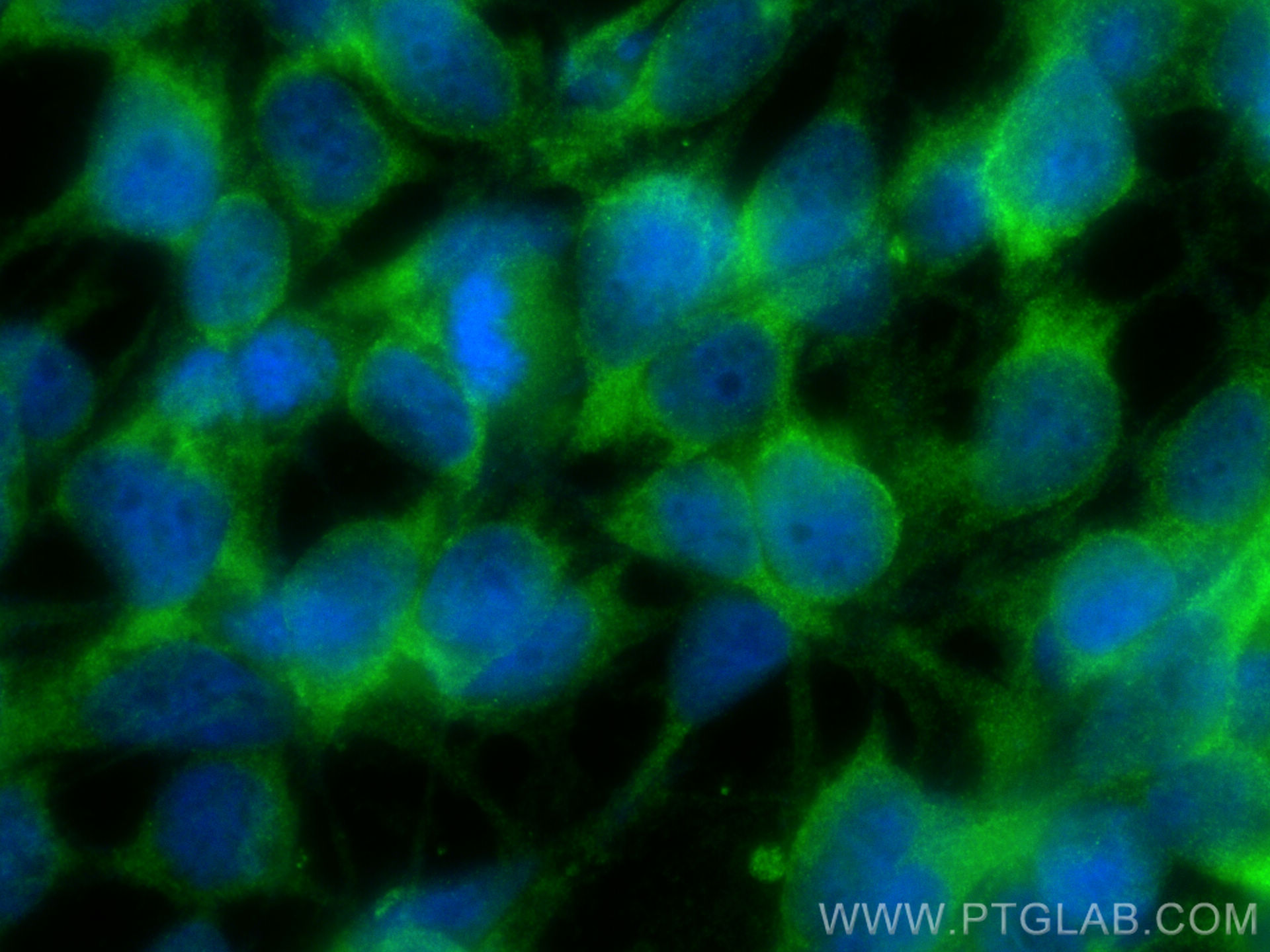 IF Staining of HEK-293 using 12119-1-AP