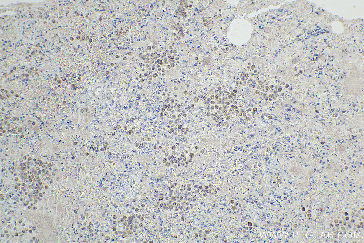 IHC staining of human lung using 12119-1-AP