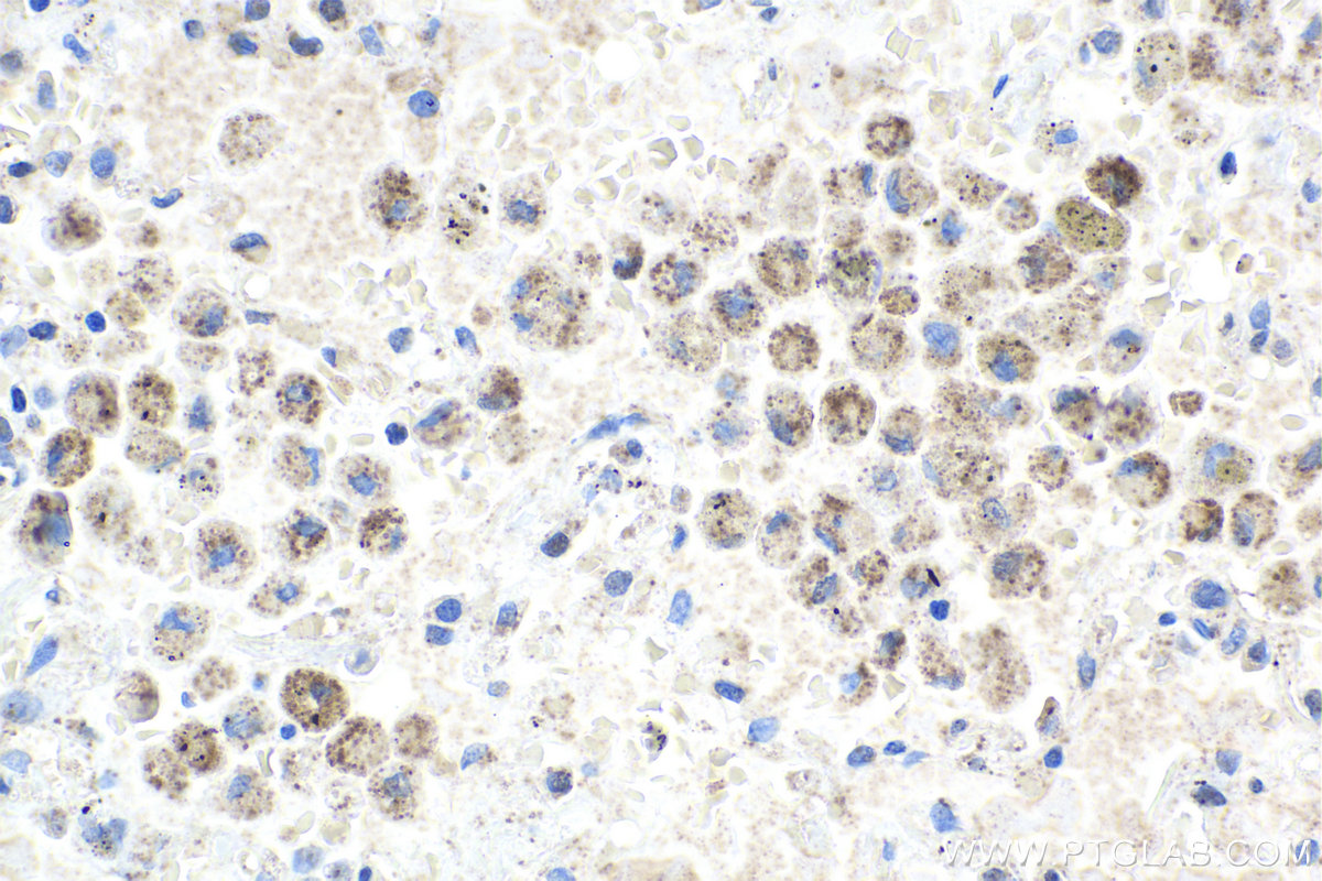 IHC staining of human lung using 12119-1-AP