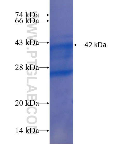 LRFN5 fusion protein Ag22152 SDS-PAGE