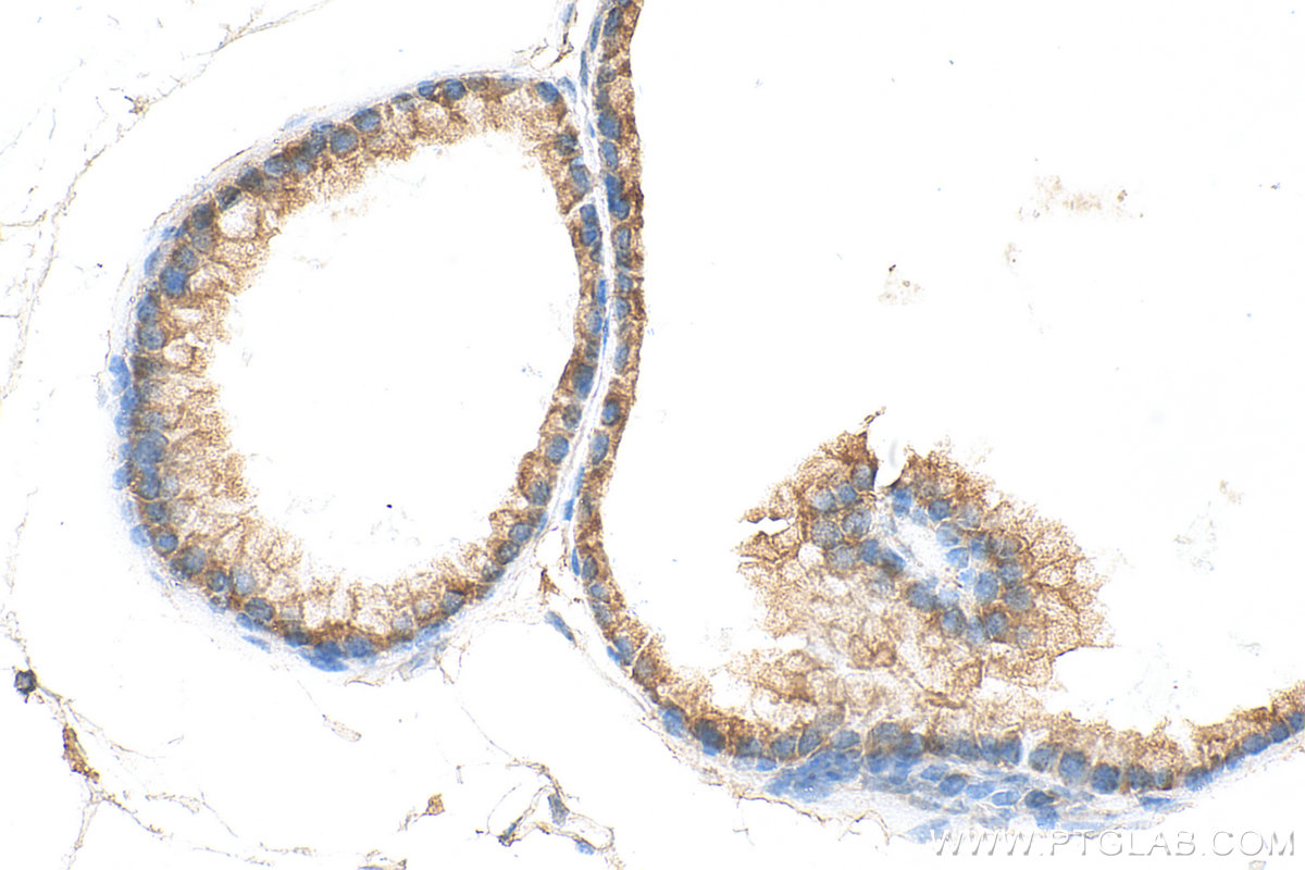 IHC staining of mouse prostate using 13224-1-AP