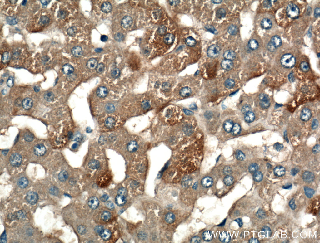 IHC staining of human liver using 13224-1-AP