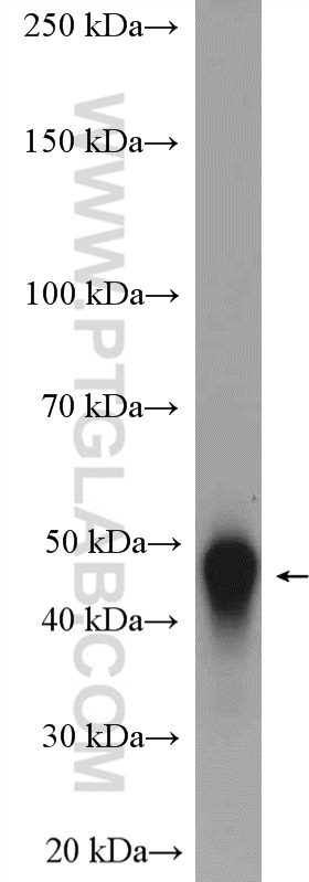 WB analysis of human plasma using 13224-1-AP