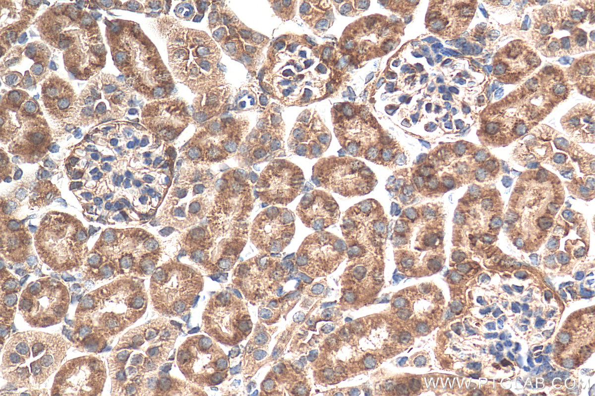 IHC staining of mouse kidney using 22383-1-AP