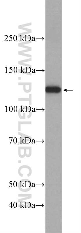 mouse liver tissue were subjected to SDS PAGE followed by western blot with 22383-1-AP (LRIG1 Antibody) at dilution of 1:1000 incubated at 4 degree celsius over night. WB analysis of mouse liver using 22383-1-AP