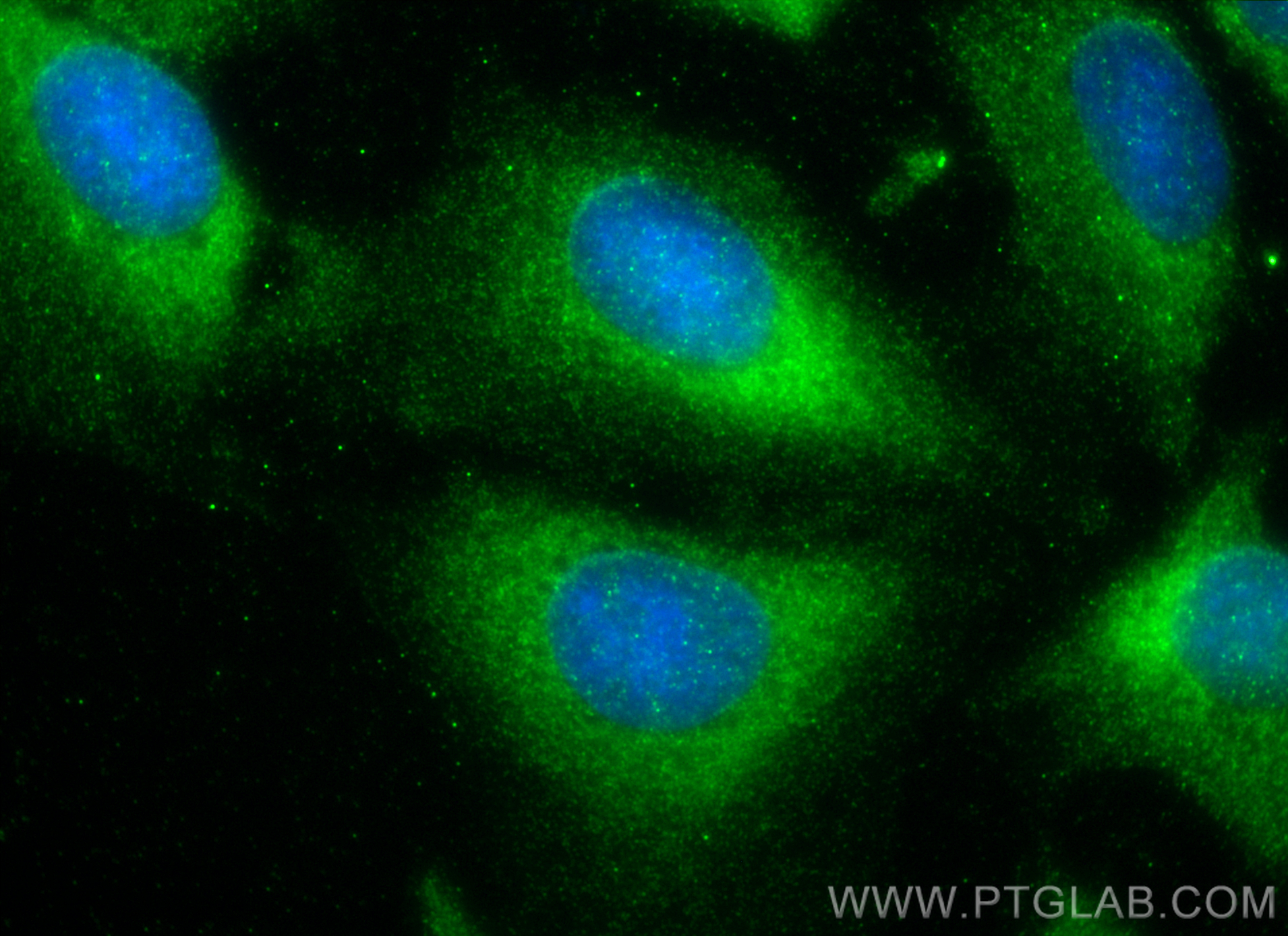 IF Staining of U2OS using 33107-1-AP