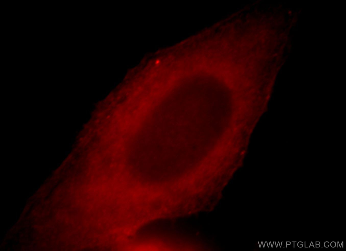 IF Staining of HepG2 using 19498-1-AP