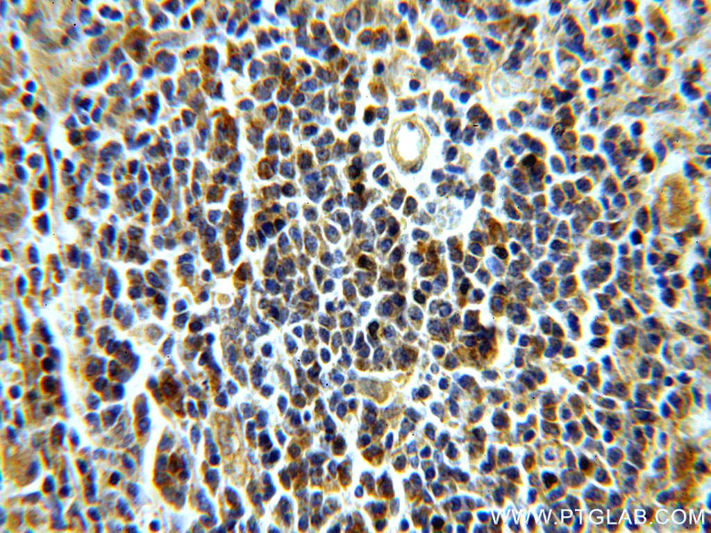 IHC staining of human spleen using 19498-1-AP