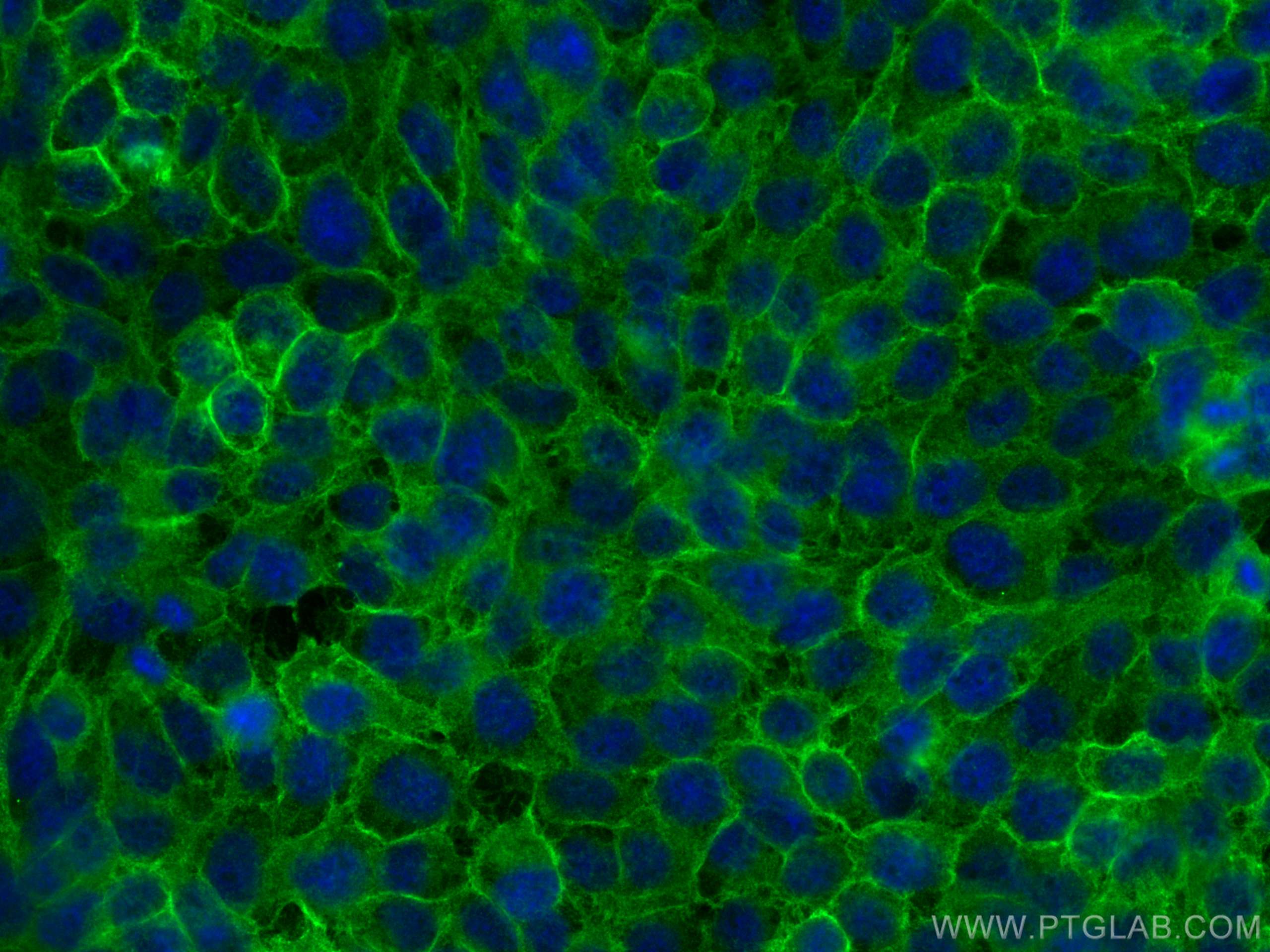 IF Staining of A431 using 13079-1-AP