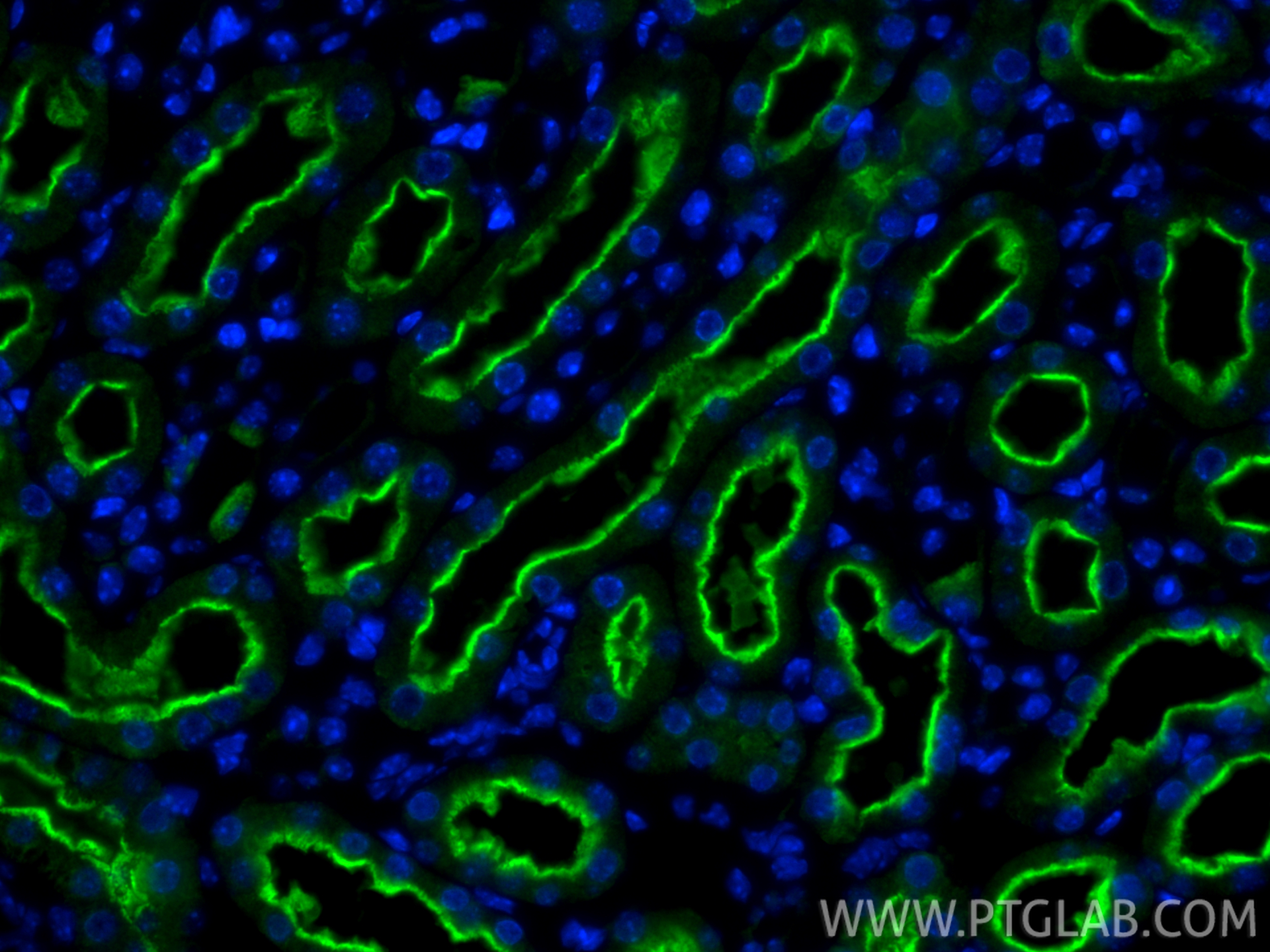 IF Staining of mouse kidney using 19700-1-AP (same clone as 19700-1-PBS)