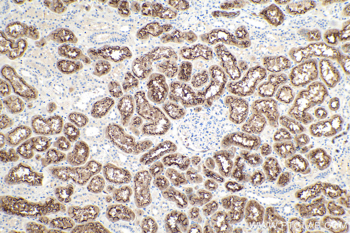 IHC staining of human kidney using 19700-1-AP