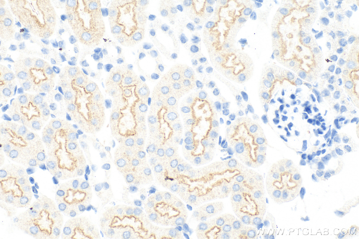 IHC staining of mouse kidney using 19700-1-AP