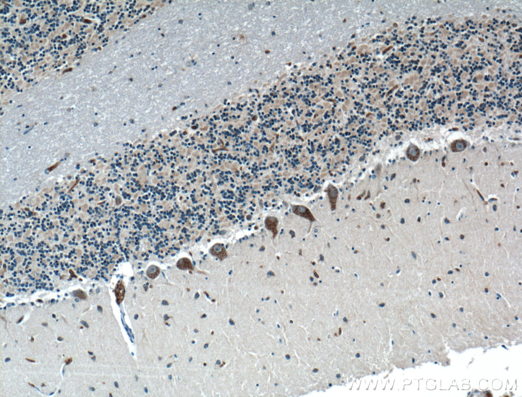 IHC staining of human cerebellum using 25783-1-AP