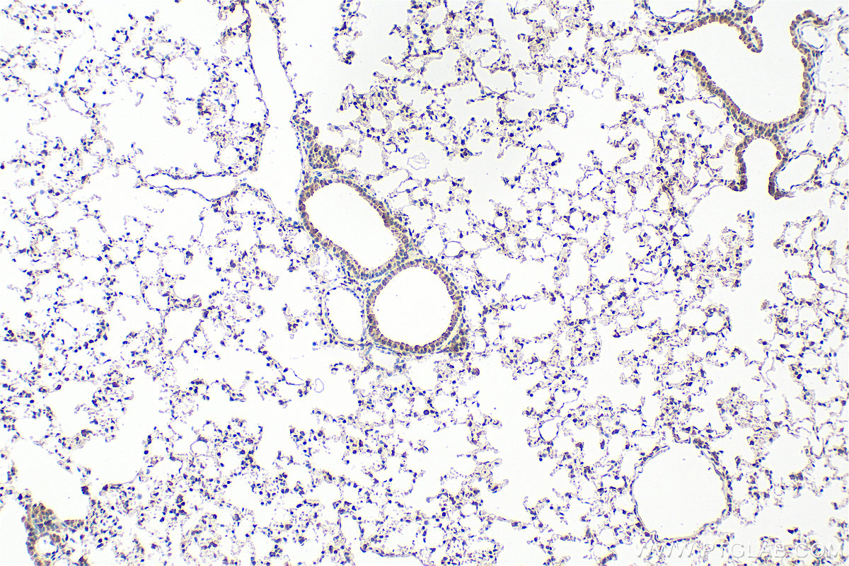 IHC staining of mouse lung using 25783-1-AP
