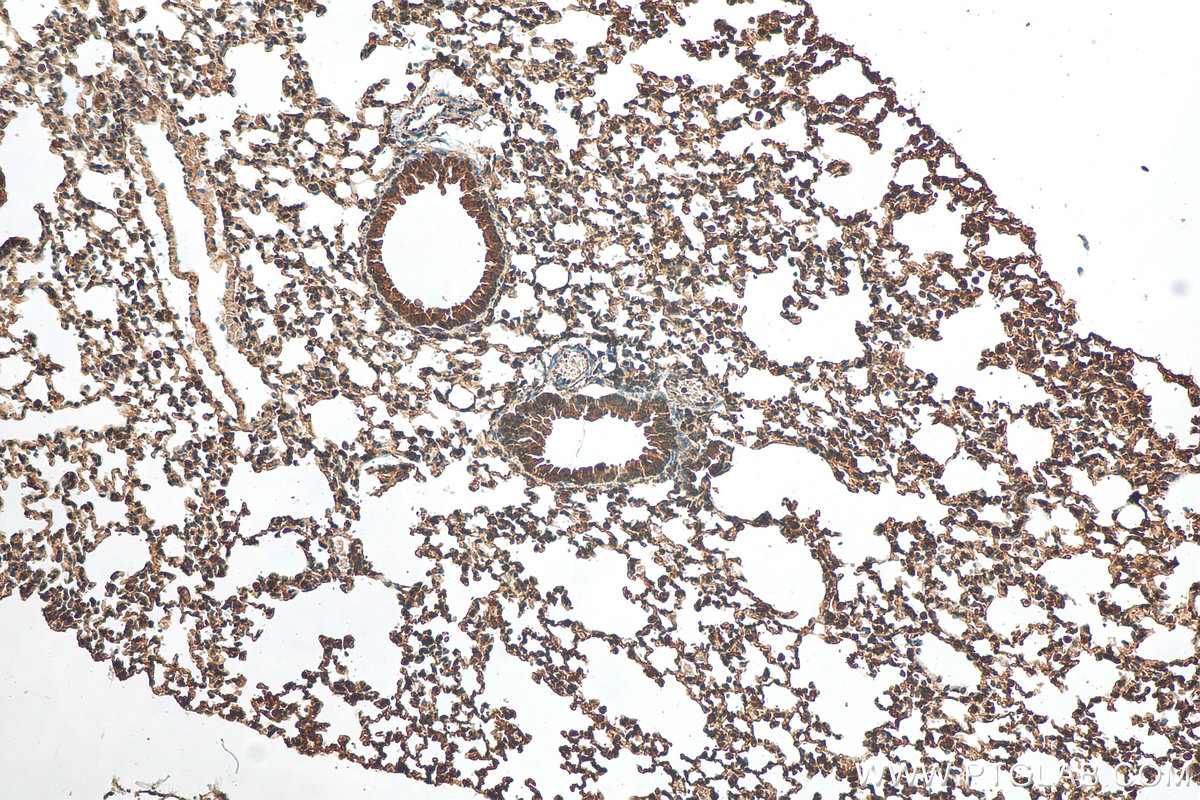 IHC staining of mouse lung using 24899-1-AP