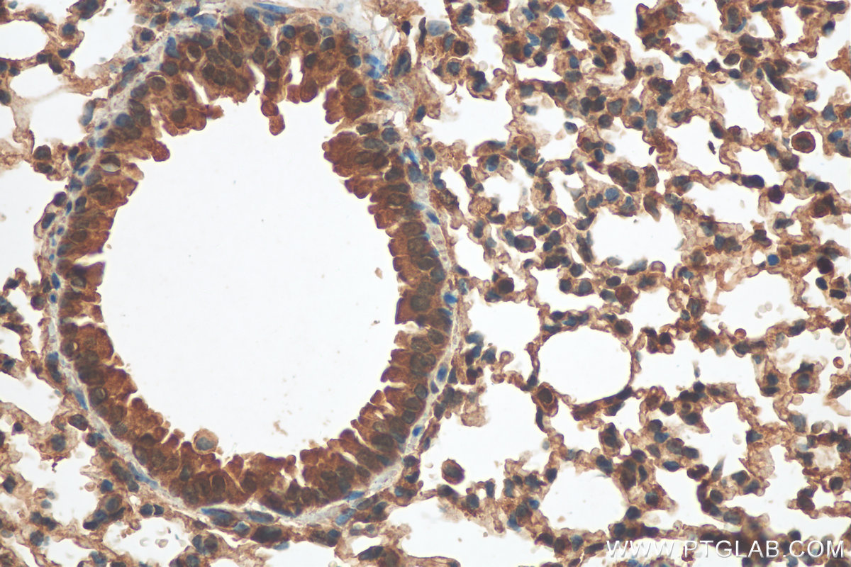 IHC staining of mouse lung using 24899-1-AP