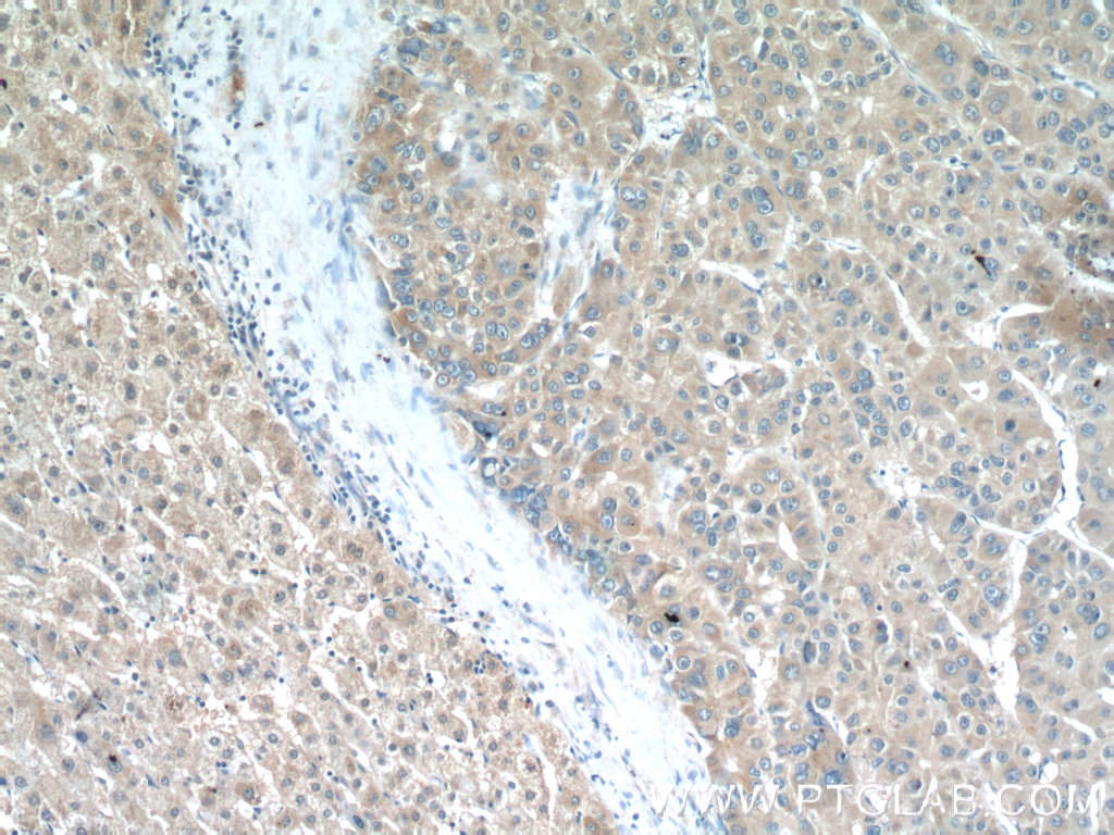 LRP5 Polyclonal antibody