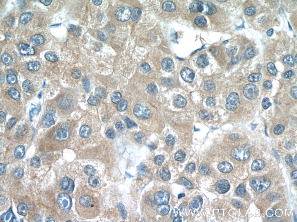 LRP5 Polyclonal antibody