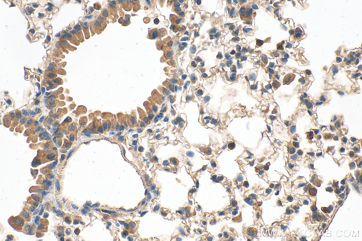 Immunohistochemical analysis of paraffin-embedded mouse lung tissue slide using 24899-1-AP (LRP5 antibody) at dilution of 1:1000 (under 40x lens). Heat mediated antigen retrieval with Tris-EDTA buffer (pH 9.0). IHC staining of mouse lung using 24899-1-AP