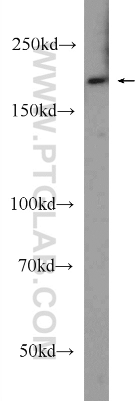 WB analysis of HeLa using 24899-1-AP