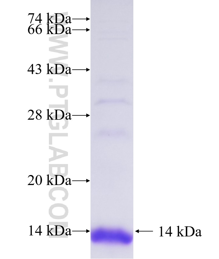 LRP5L fusion protein Ag36395 SDS-PAGE LRP5L fusion protein Ag36395 SDS-PAGE