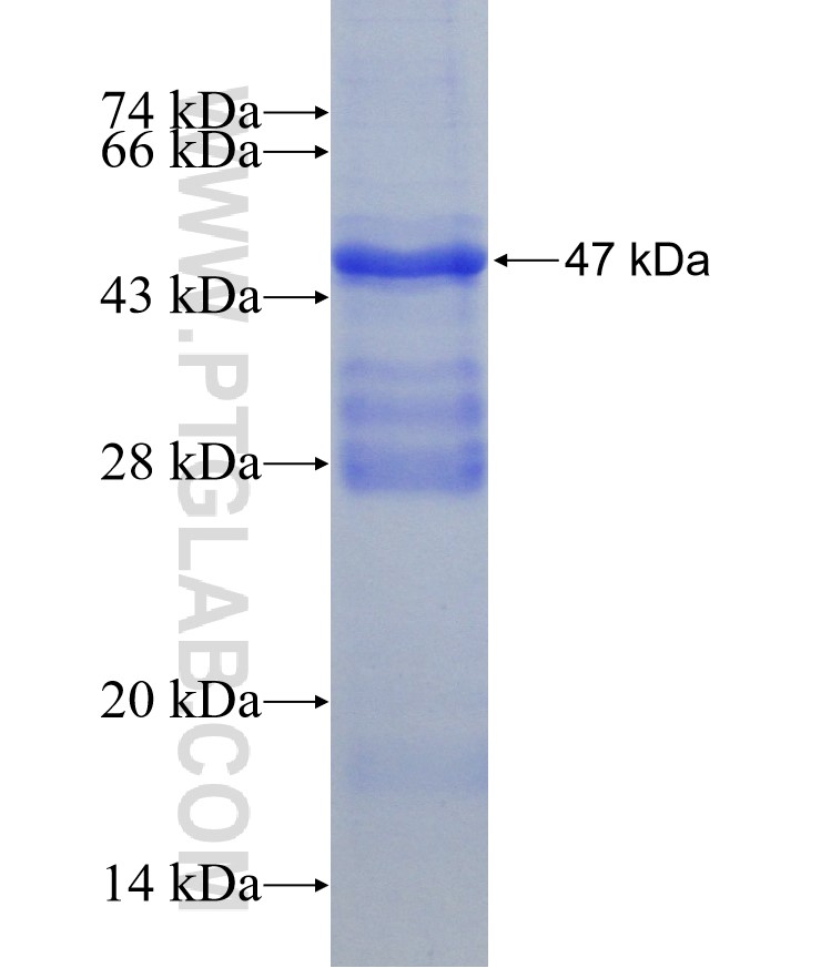LRP6 fusion protein Ag24147 SDS-PAGE LRP6 fusion protein Ag24147 SDS-PAGE