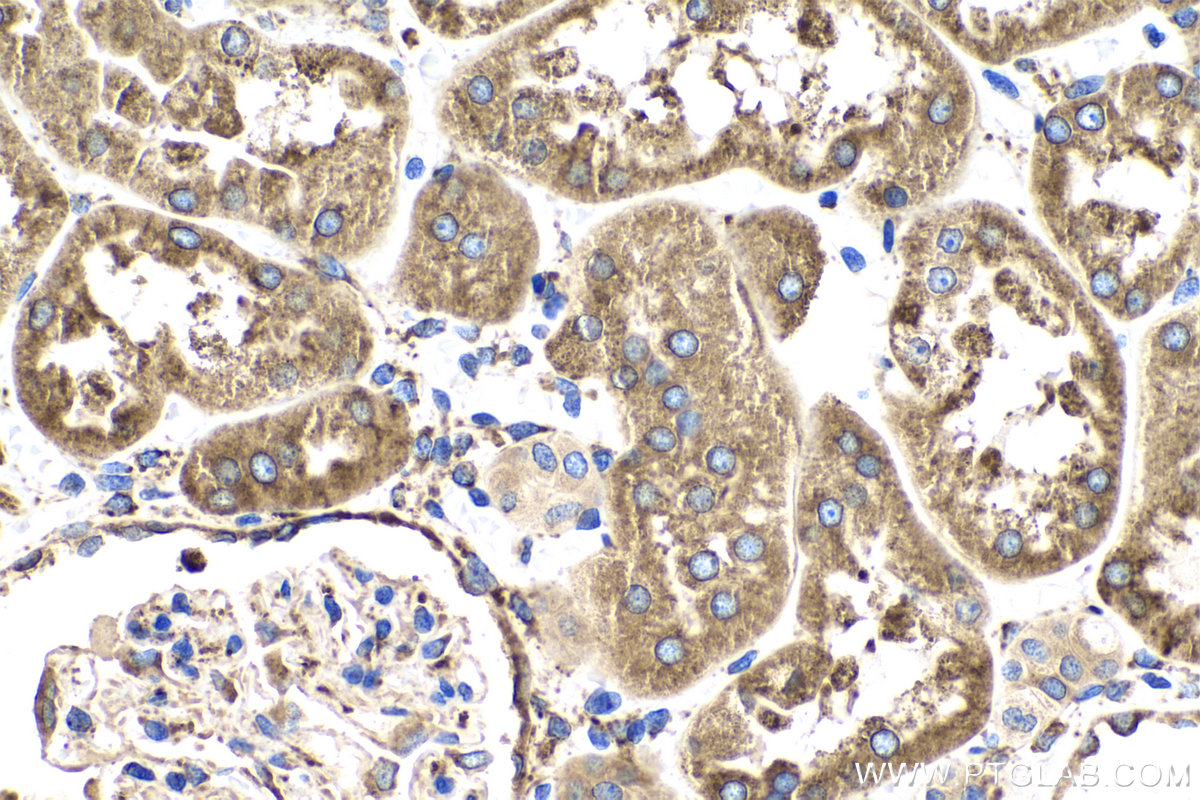 IHC staining of human kidney using 24662-1-AP