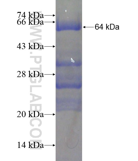 LRPAP1 fusion protein Ag20304 SDS-PAGE