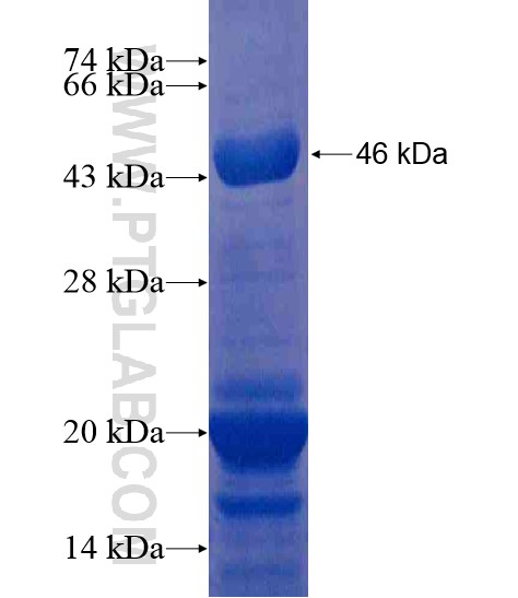 LRPAP1 fusion protein Ag20406 SDS-PAGE LRPAP1 fusion protein Ag20406 SDS-PAGE