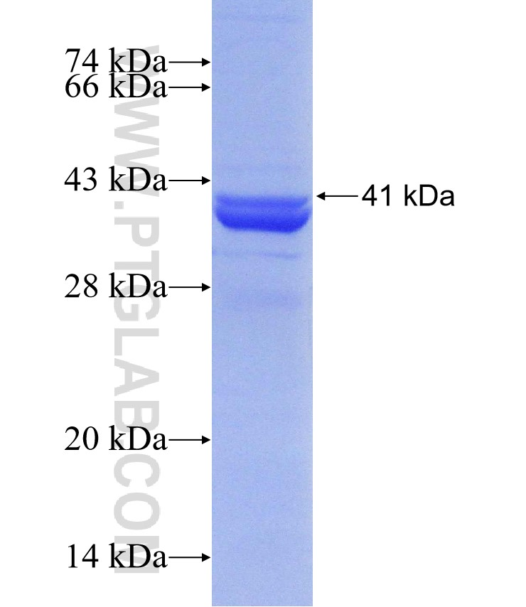 LRPPRC fusion protein Ag30261 SDS-PAGE