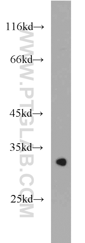 WB analysis of mouse brain using 21575-1-AP