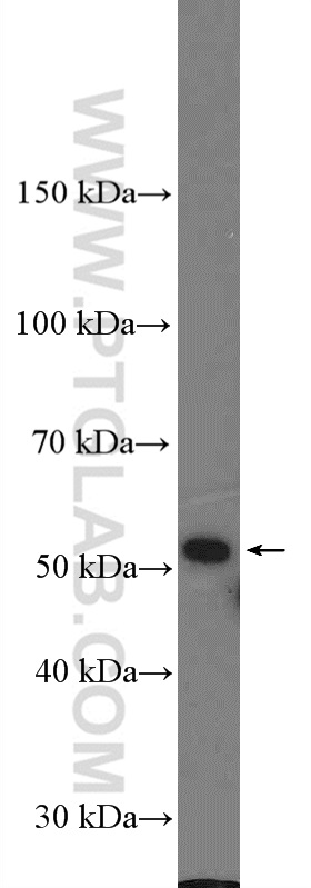 WB analysis of HeLa using 20918-1-AP