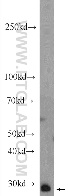 WB analysis of mouse testis using 24571-1-AP