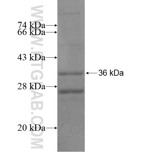 LRRC18 fusion protein Ag14894 SDS-PAGE LRRC18 fusion protein Ag14894 SDS-PAGE