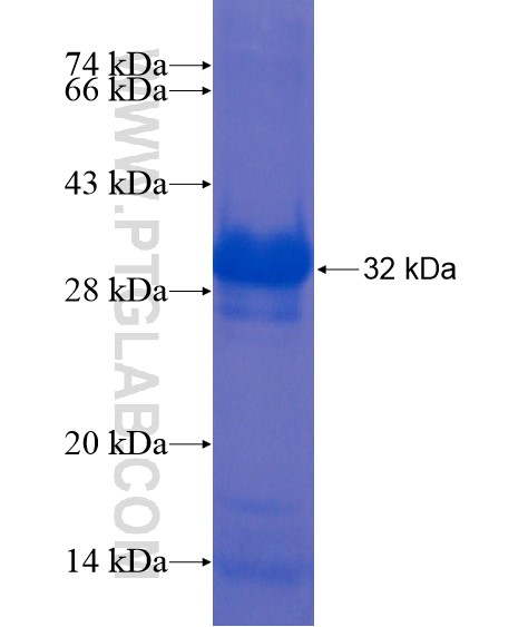 LRRC19 fusion protein Ag21864 SDS-PAGE LRRC19 fusion protein Ag21864 SDS-PAGE