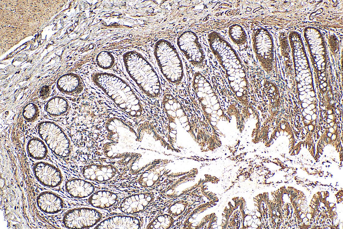 IHC staining of human colon using 25562-1-AP