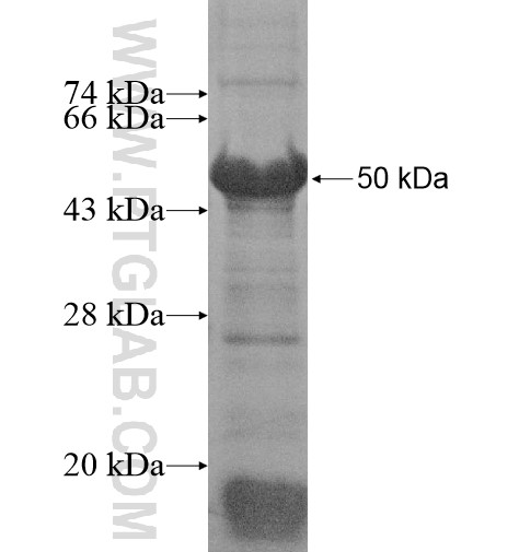 LRRC23 fusion protein Ag15258 SDS-PAGE LRRC23 fusion protein Ag15258 SDS-PAGE