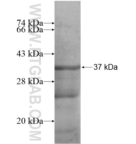 LRRC25 fusion protein Ag15076 SDS-PAGE LRRC25 fusion protein Ag15076 SDS-PAGE