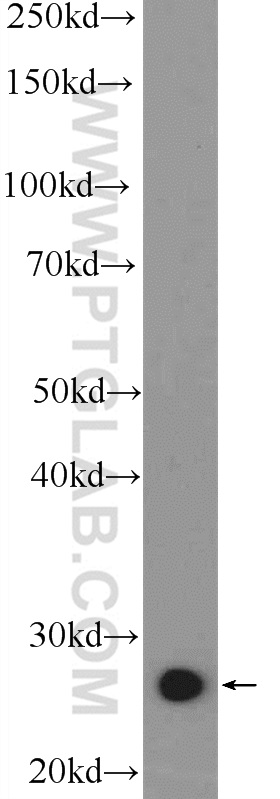 WB analysis of mouse liver using 25664-1-AP