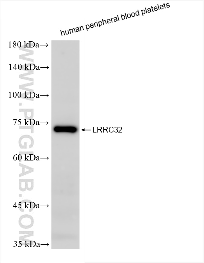 WB analysis of human peripheral blood platelets using 86059-2-RR