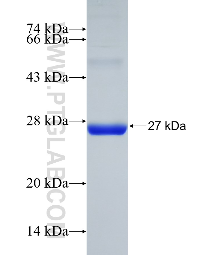 LRRC33 fusion protein Ag31347 SDS-PAGE LRRC33 fusion protein Ag31347 SDS-PAGE