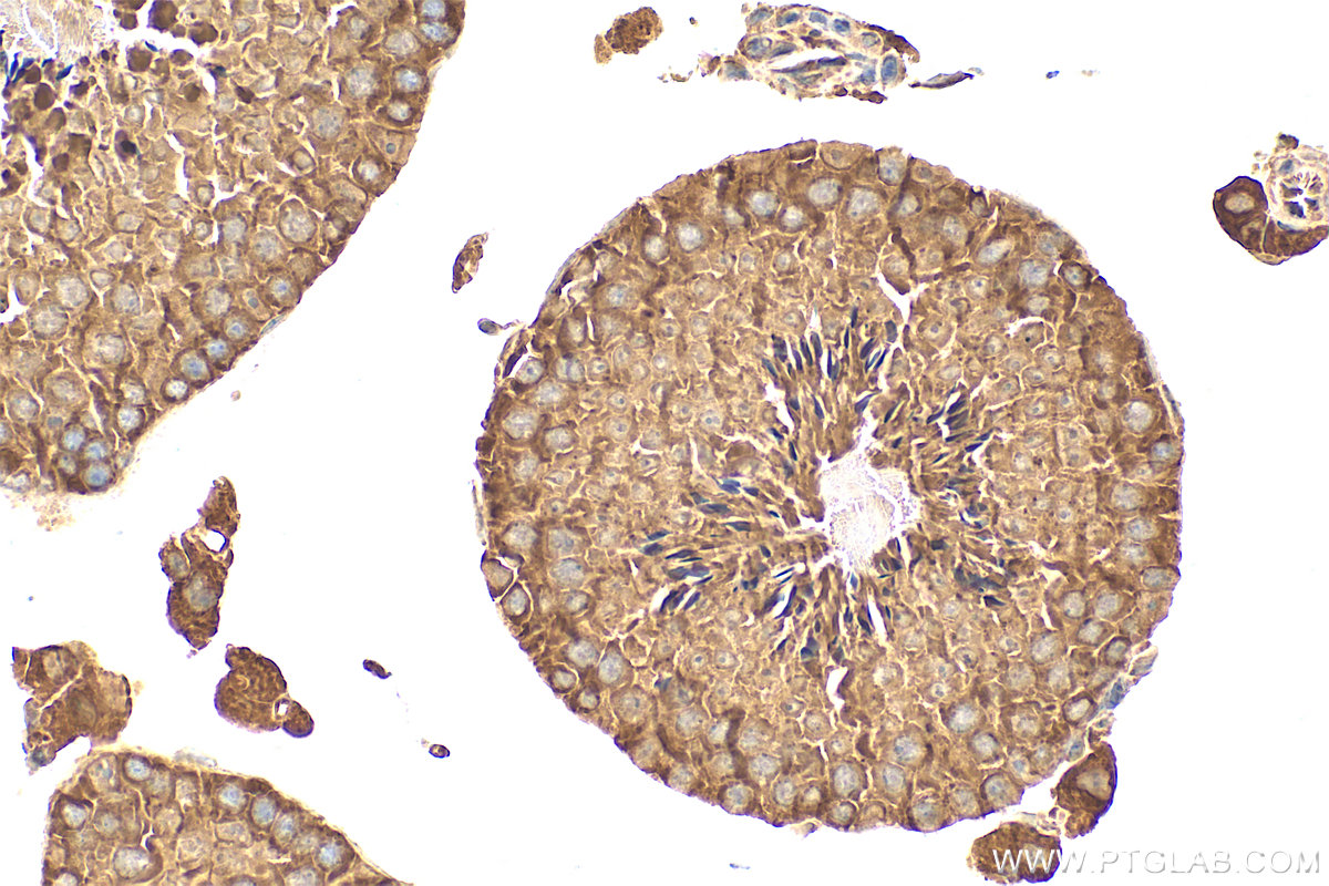 Immunohistochemical analysis of paraffin-embedded mouse testis tissue slide using 32450-1-AP (LRRC37A2 antibody) at dilution of 1:200 (under 40x lens). Heat mediated antigen retrieval with Tris-EDTA buffer (pH 9.0). IHC staining of mouse testis using 32450-1-AP