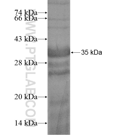 LRRC4 fusion protein Ag20376 SDS-PAGE